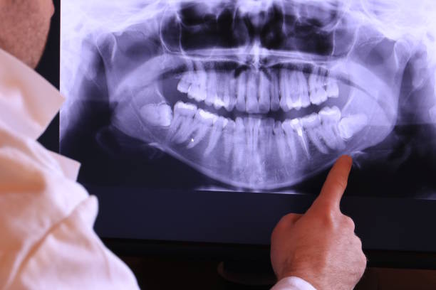 Best Emergency Dental Care for Trauma or Injury in Johnston, SC