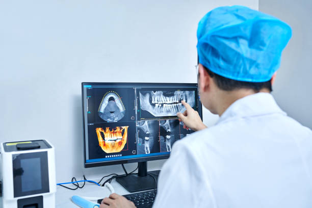 Best Emergency Wisdom Teeth Removal in Johnston, SC